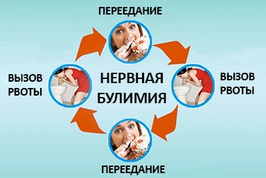 Лечение булимии в Емве